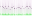 es10500a_01_parPos